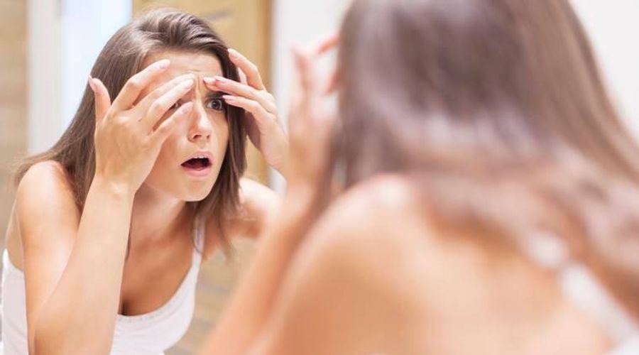 Ciri Fungal Acne Dan Cara Mengatasinya