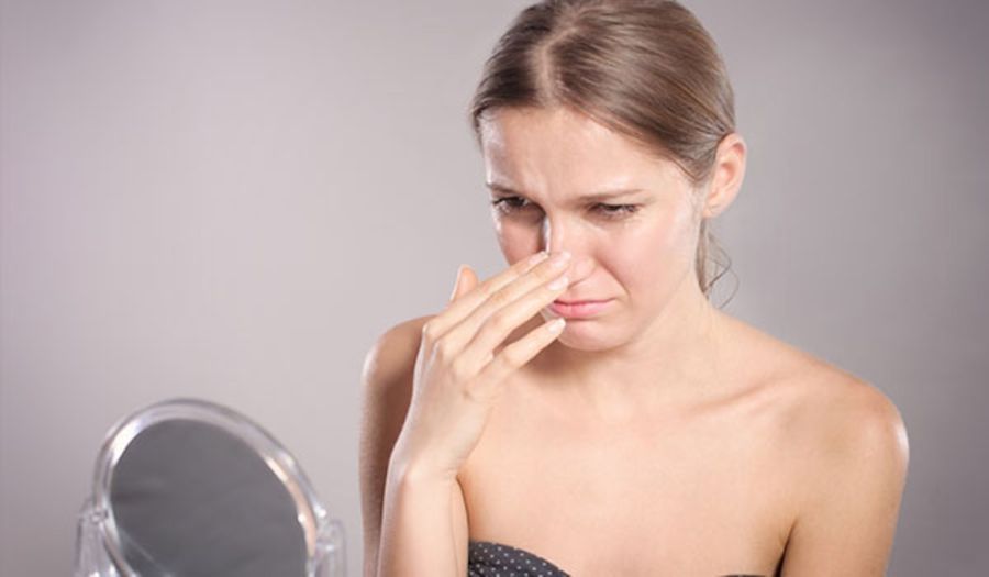 Menghilangkan Komedo Secara Alami