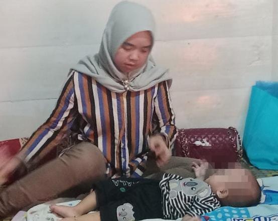 Heboh Bayi 10 Bulan di Palembang Punya Dua Kelamin