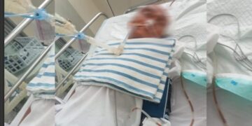 Nestapa Wanita Lansia di Padang Pariaman, Cucu Diduga Dicabuli, Dirinya Malah Dianiaya Anak Pelaku Hingga Kritis di RS