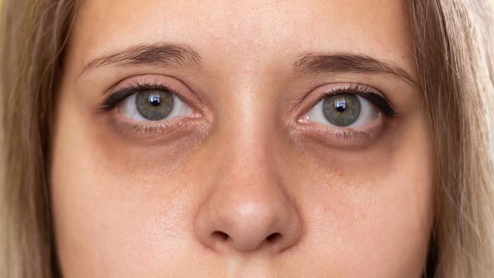 eyee