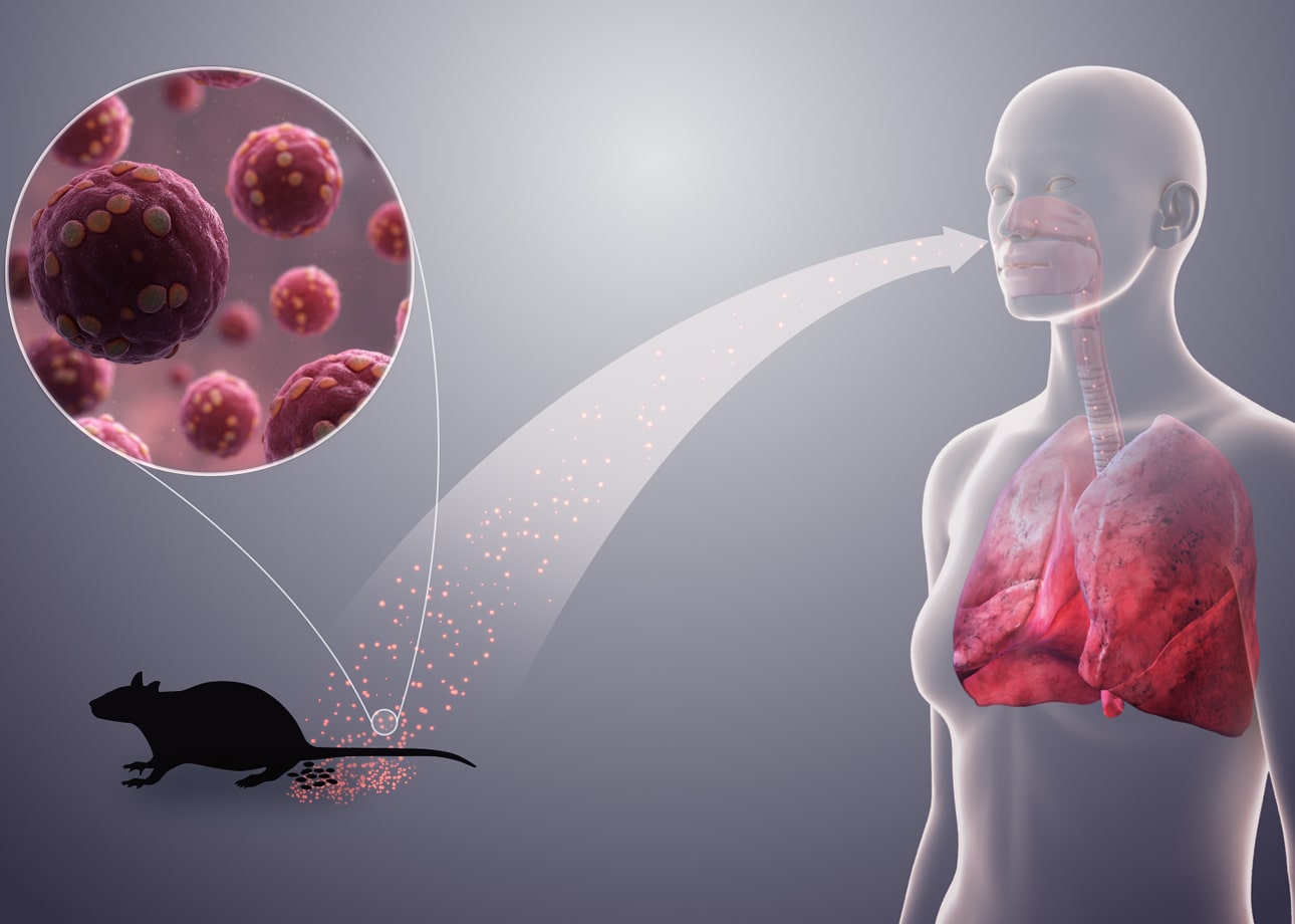 Mengenal Hantavirus: Gejala, Cara Penularan, dan Langkah Pencegahan pastirumah.com