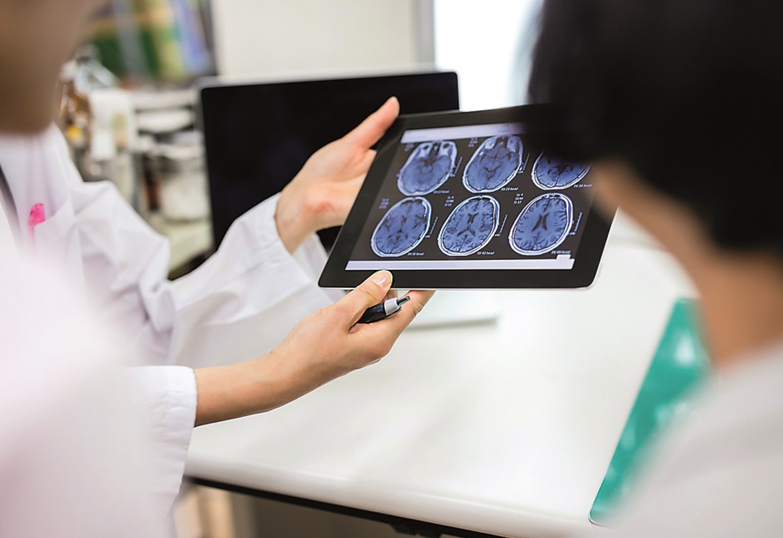 Apa Itu Golden Period Stroke dan Pertolongan Pertamanya