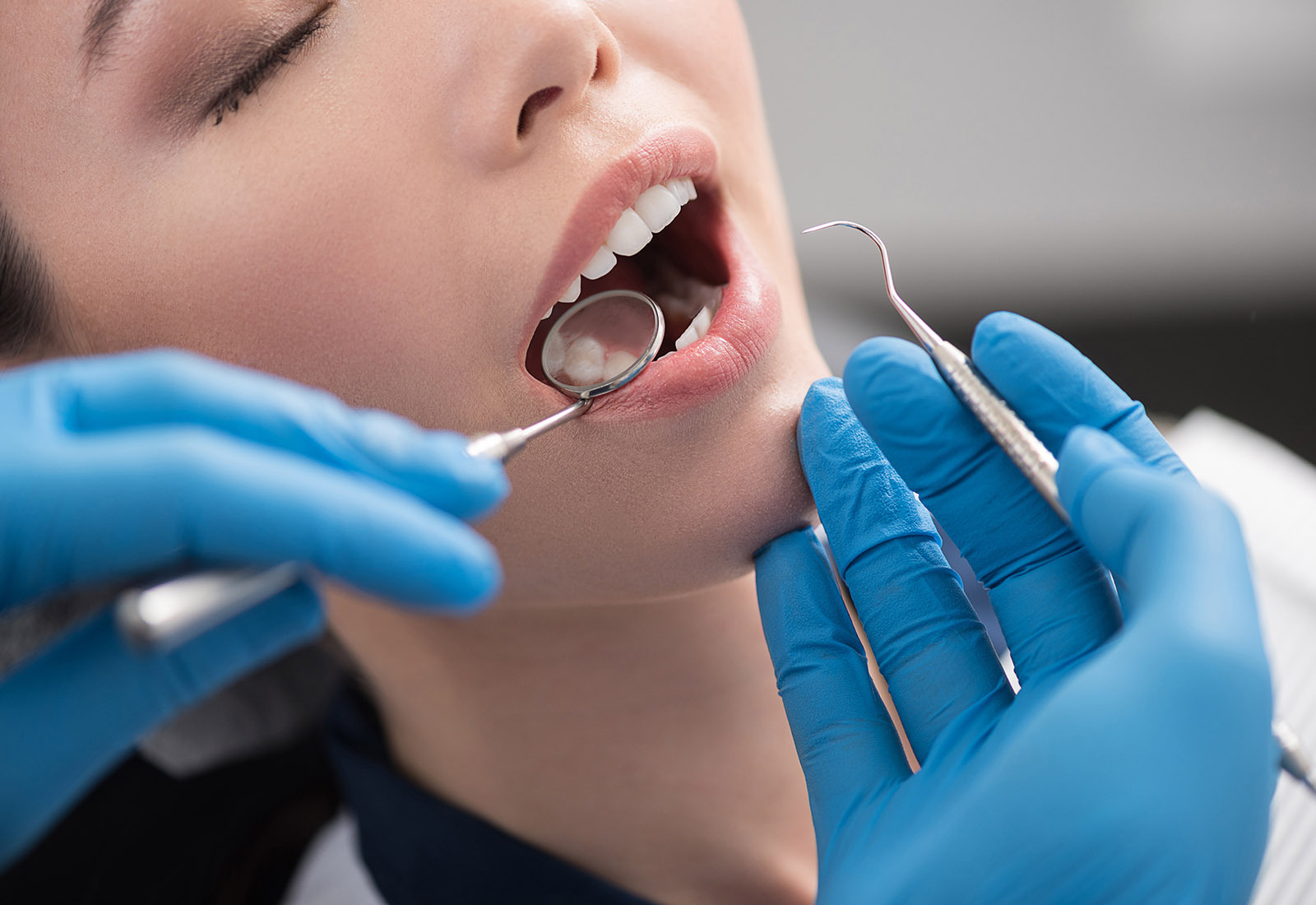 Penanganan Khusus pada Gigi Berlubang