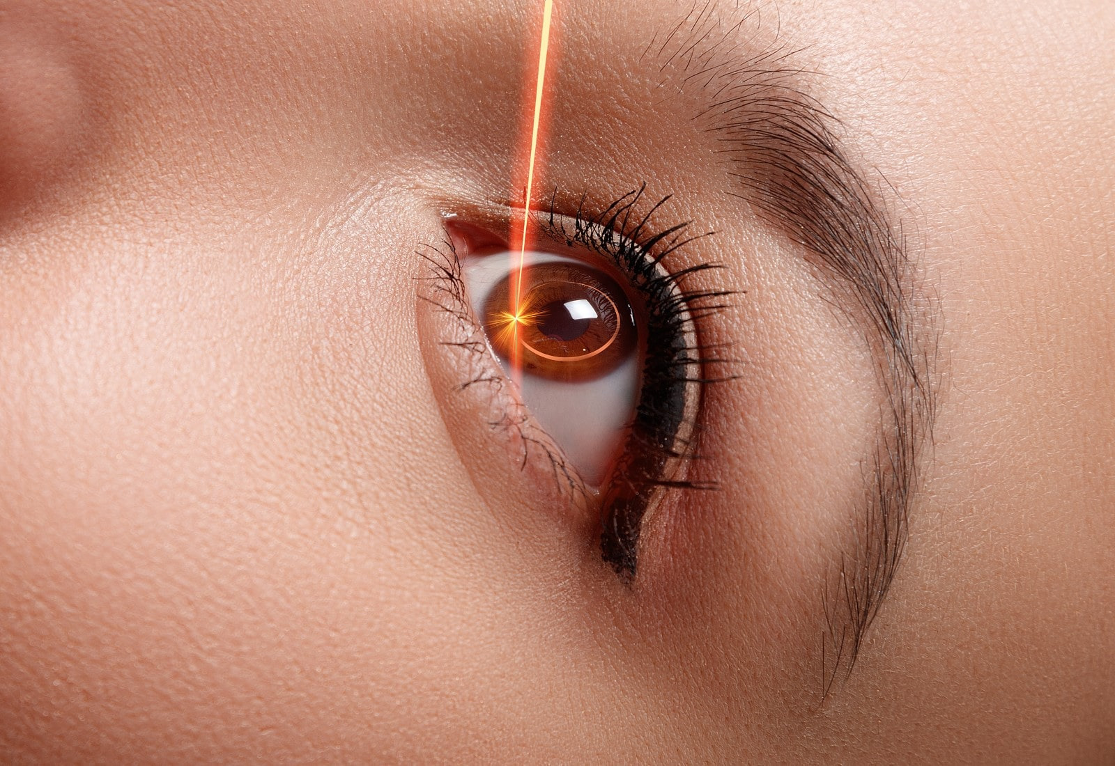 Operasi Lasik Mata, Prosedur, dan Efek Sampingnya