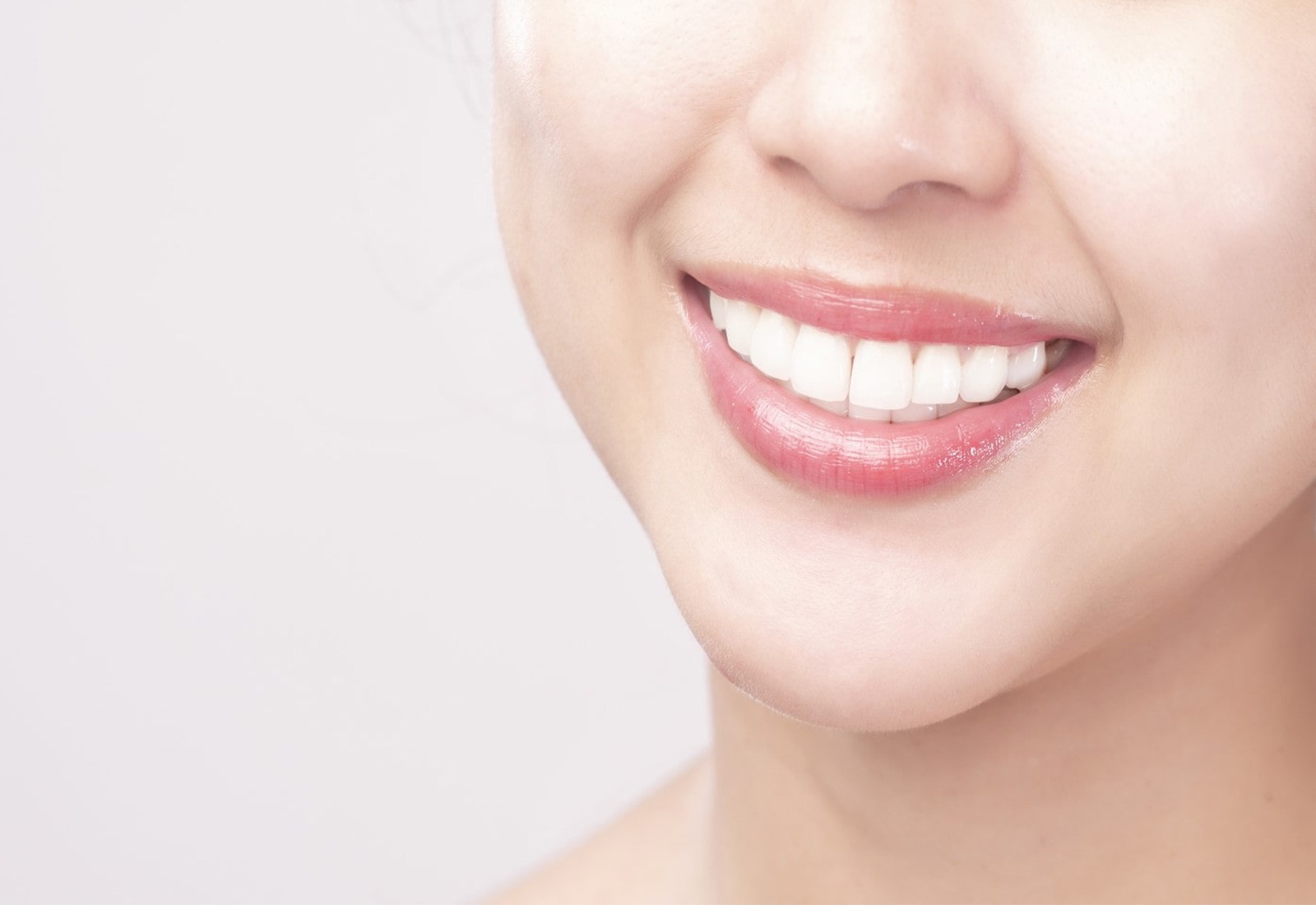 Mengenal Pemasangan Veneer Gigi untuk Senyum Sehat dan Estetik