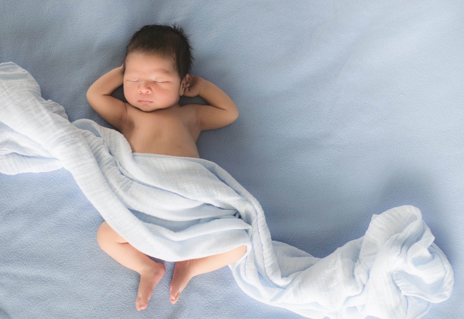 Hidrokel pada Bayi yang Menyebabkan Buah Zakar Si Kecil Bengkak