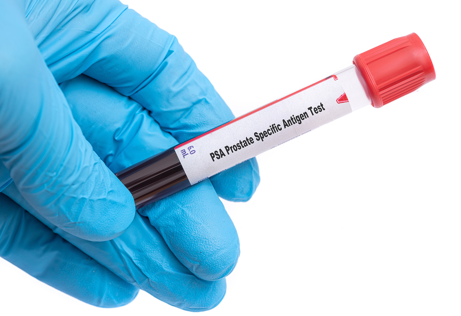 Lupus Eritematosus Sistemik, Penyakit yang Menyerang Banyak Organ 