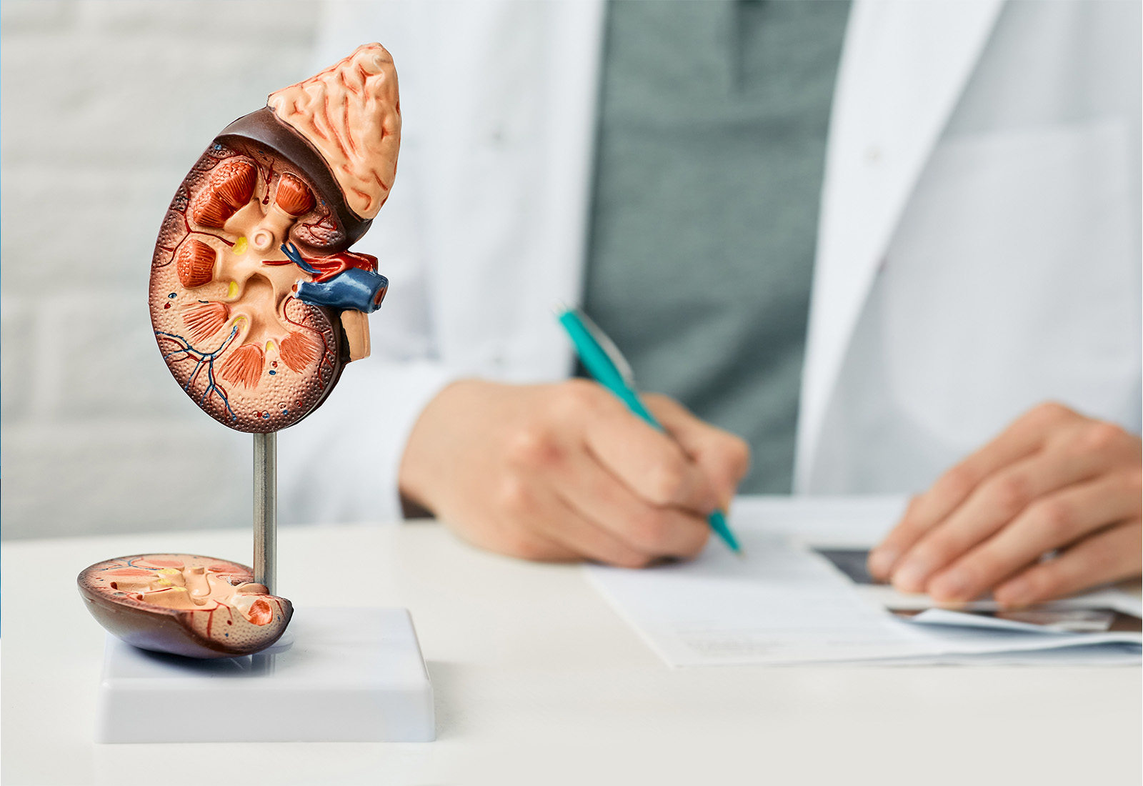 Mengenal Lupus Nefritis, Komplikasi Serius dari Penyakit Lupus
