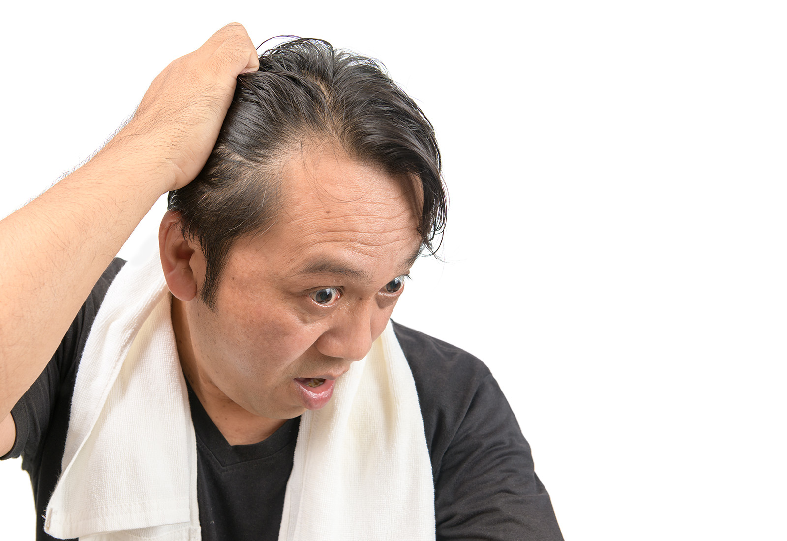 Periksa Rambut Rontok ke Dokter Apa?