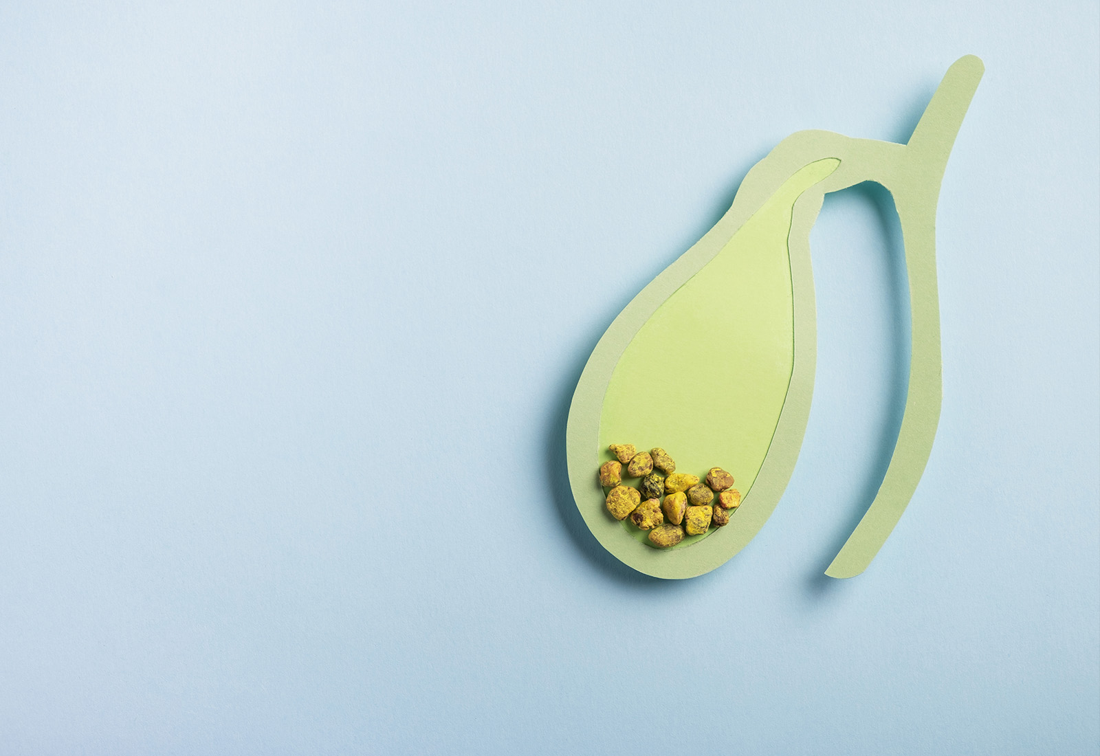 Periksa Batu Empedu ke Dokter Apa?