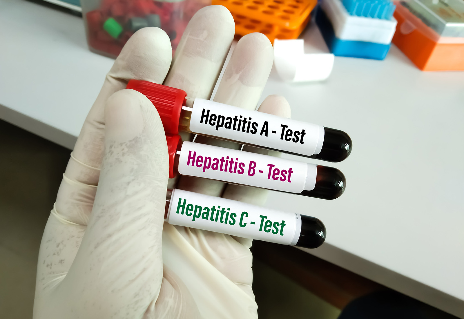 Kenali Perbedaan Hepatitis A, B, dan C