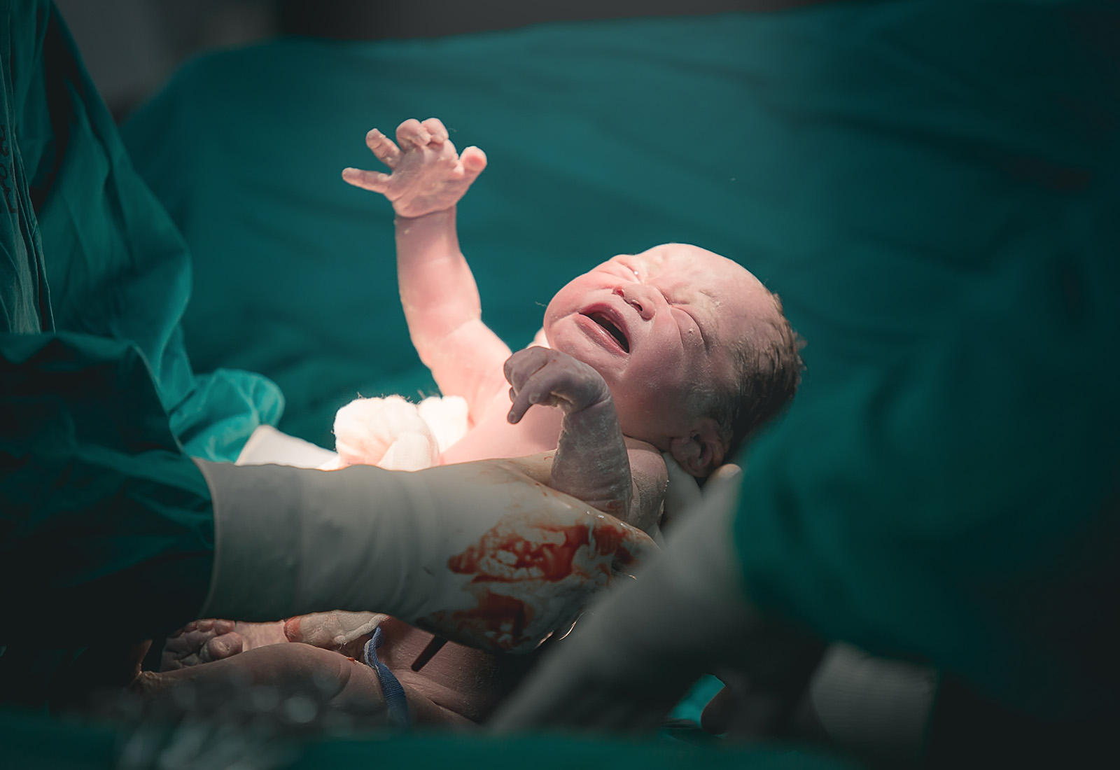 Persalinan Caesar di Jakarta dan Tangerang dengan RS Pondok Indah