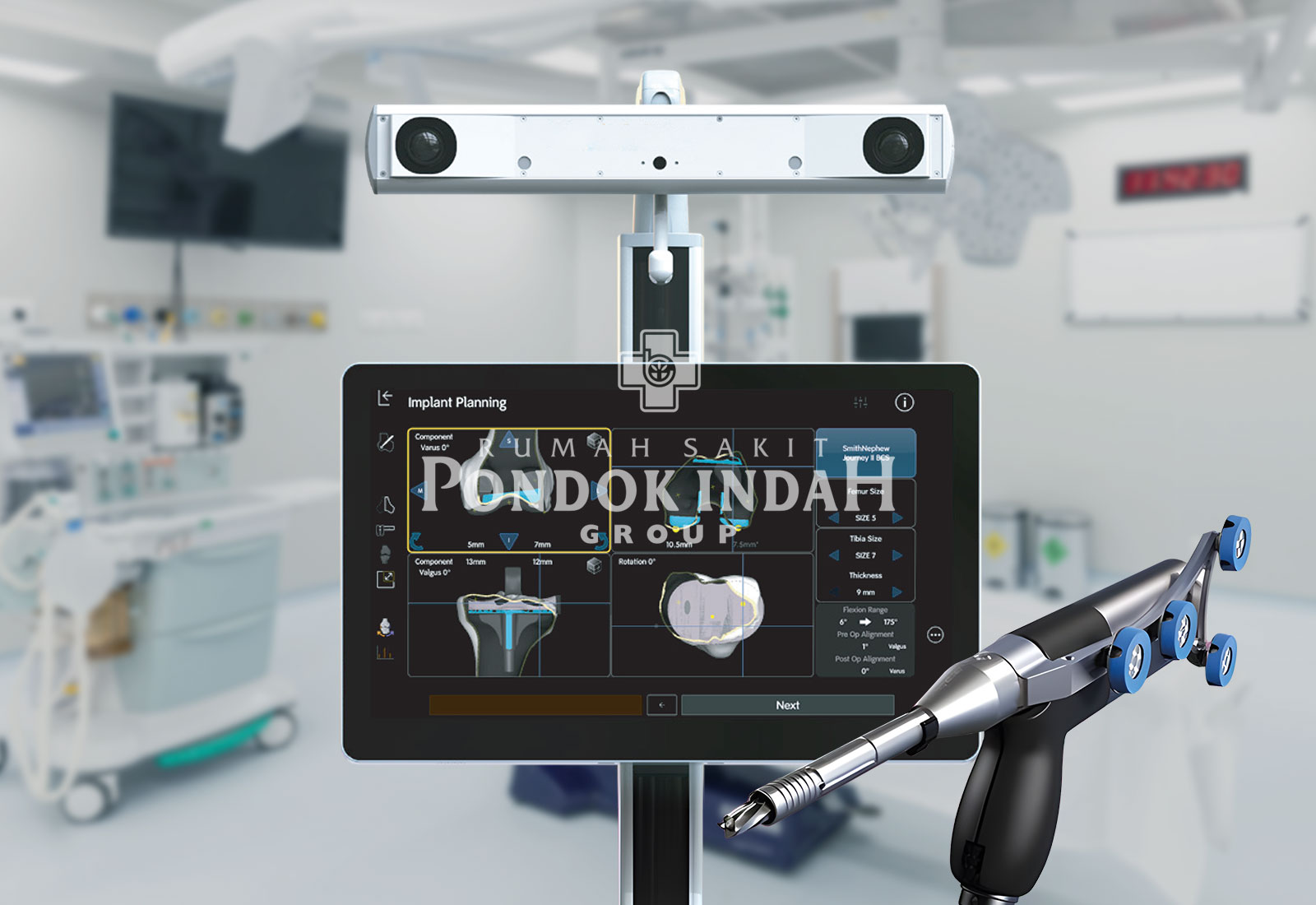 Mengenal Robotic TKR, Penggantian Sendi Lutut dengan Bantuan Robot