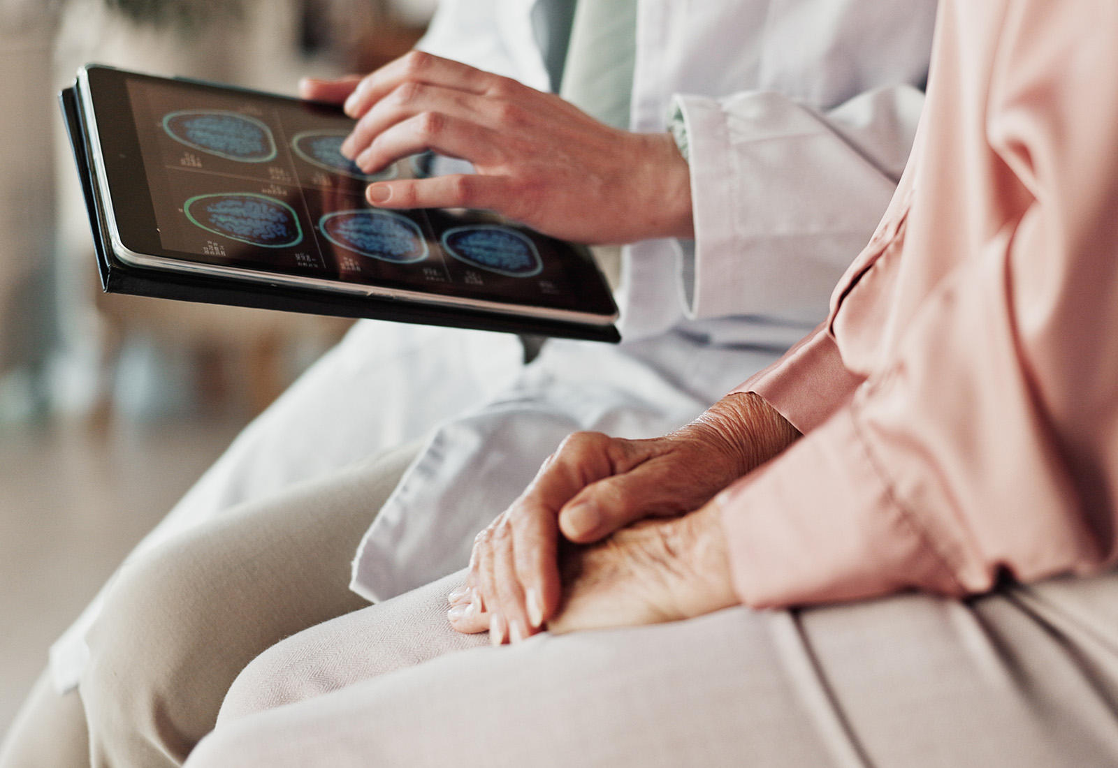 Apakah Aneurisma Otak Bisa Sembuh? Temukan Jawabannya di Sini 