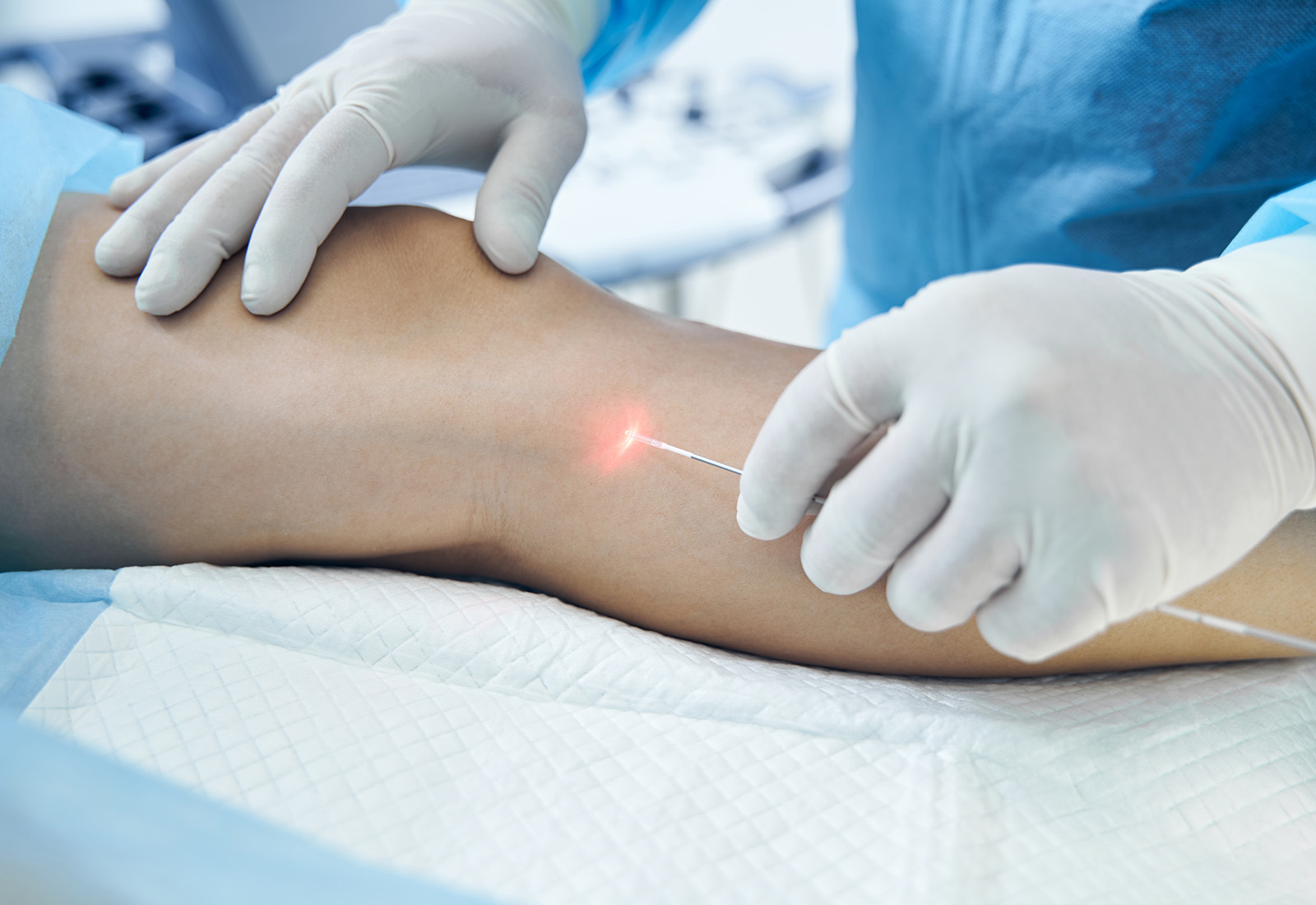 EVLA di Jakarta dan Tangerang, untuk Hasil Efektif dan Pemulihan yang Lebih Cepat