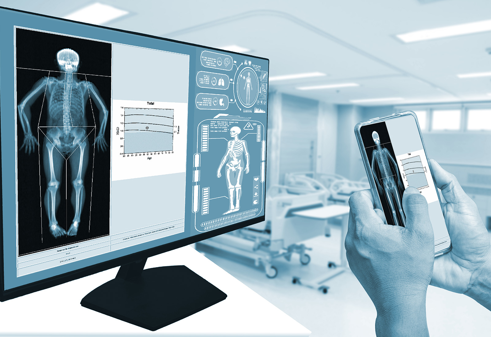 Mengenal DEXA Scan, Pengukuran Kepadatan Tulang dan Komposisi Lemak Serta Otot yang Akurat
