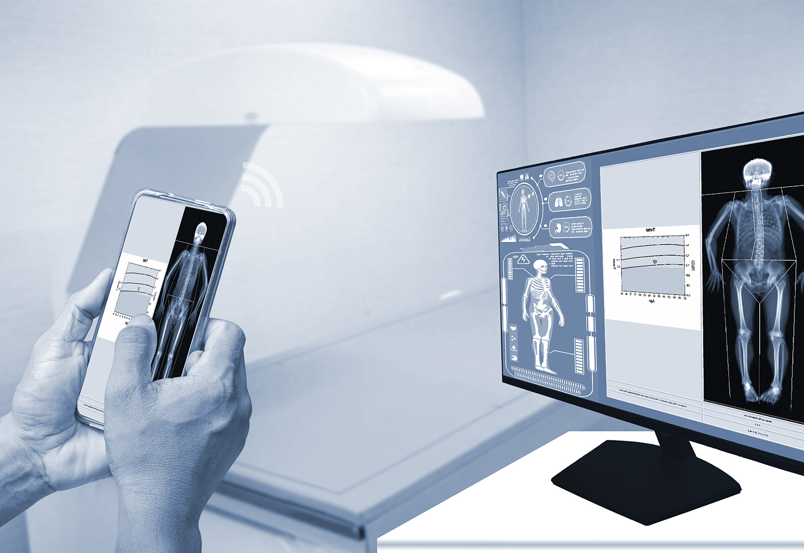 DEXA Scan di Jakarta dan Tangerang dengan RS Pondok Indah, Pemeriksaan Kesehatan dengan Hasil yang Akurat