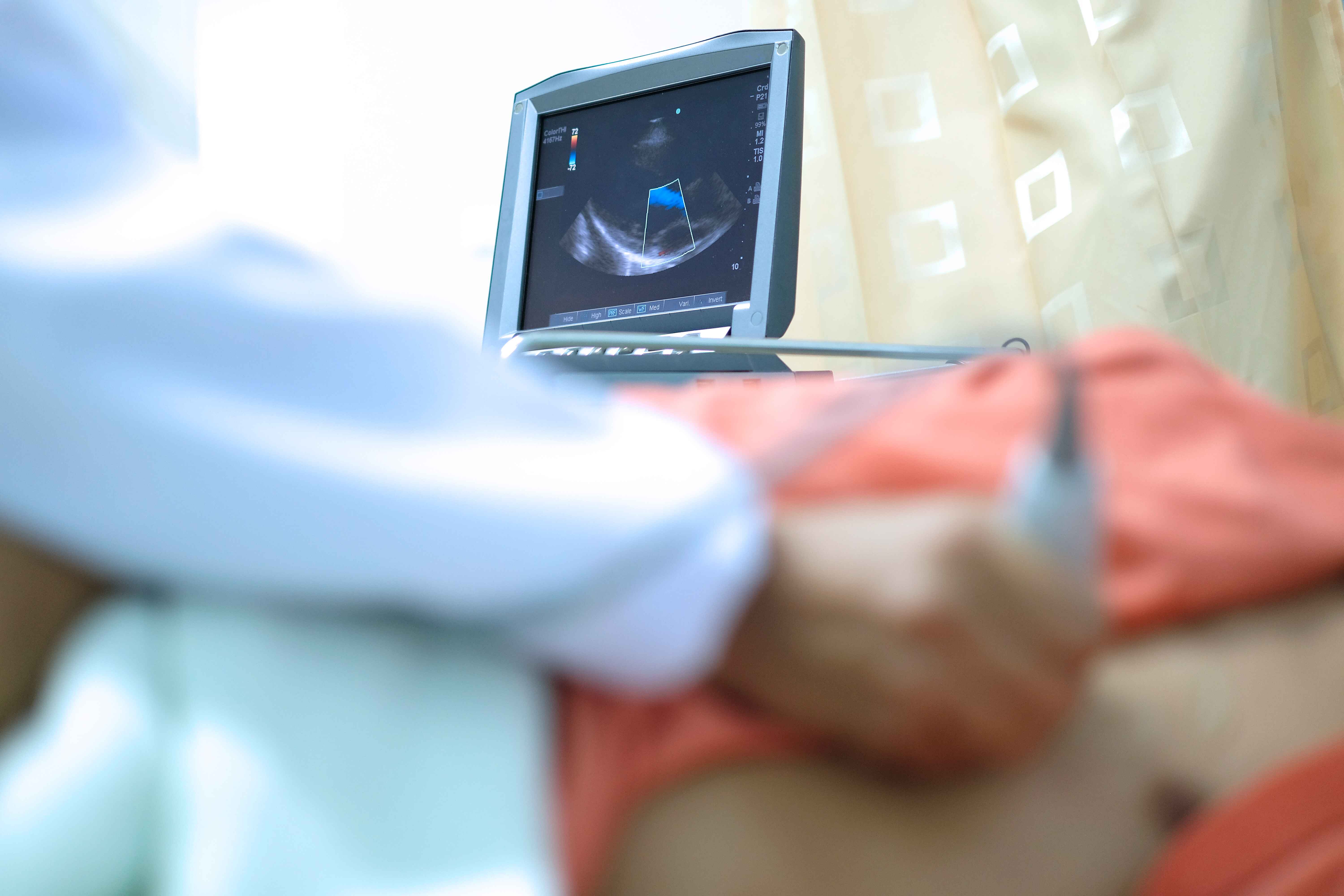 Peran Vital Echocardiography dalam Diagnostik Jantung