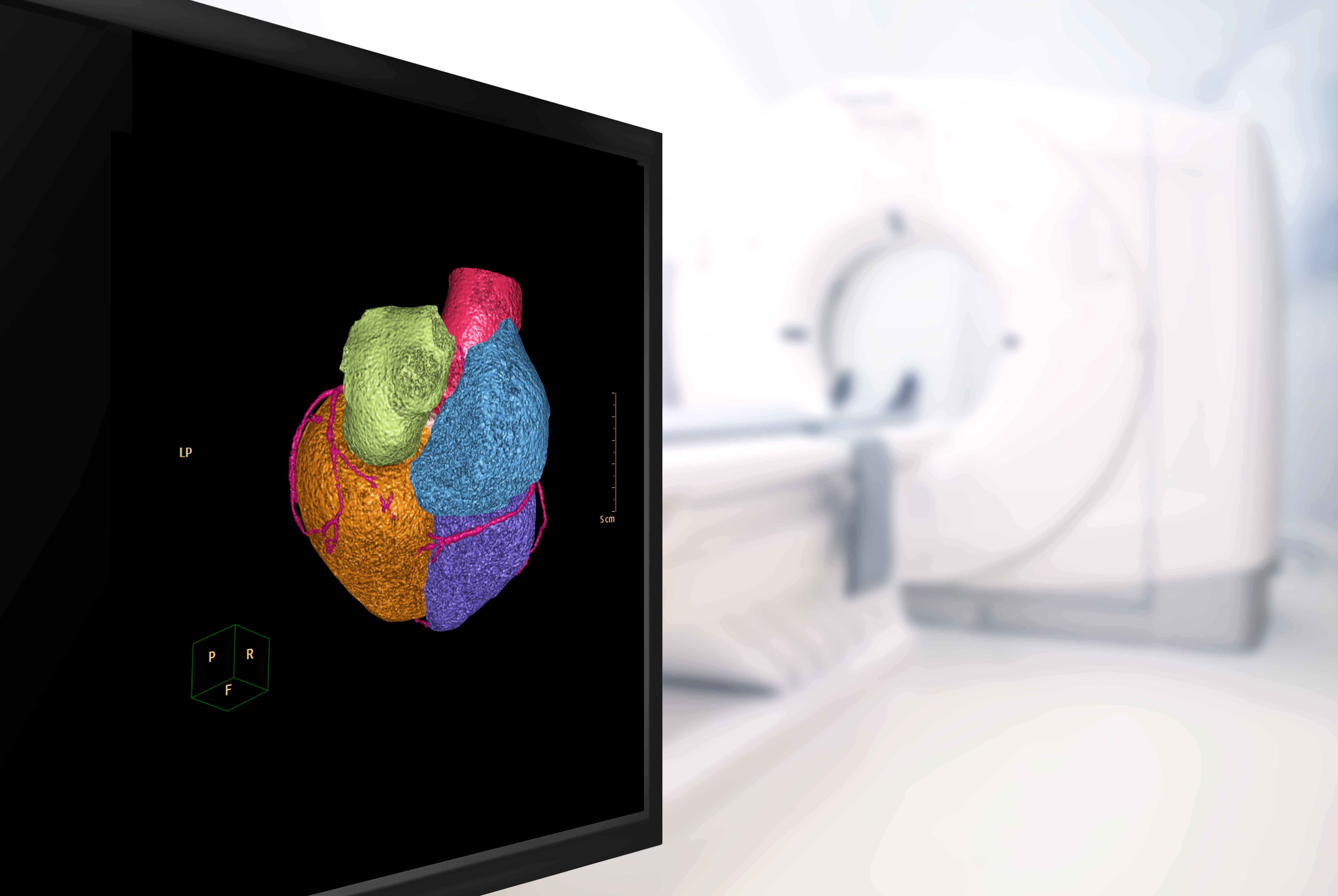 CT Scan Jantung: Cara Kerja, Indikasi, dan Prosedurnya
