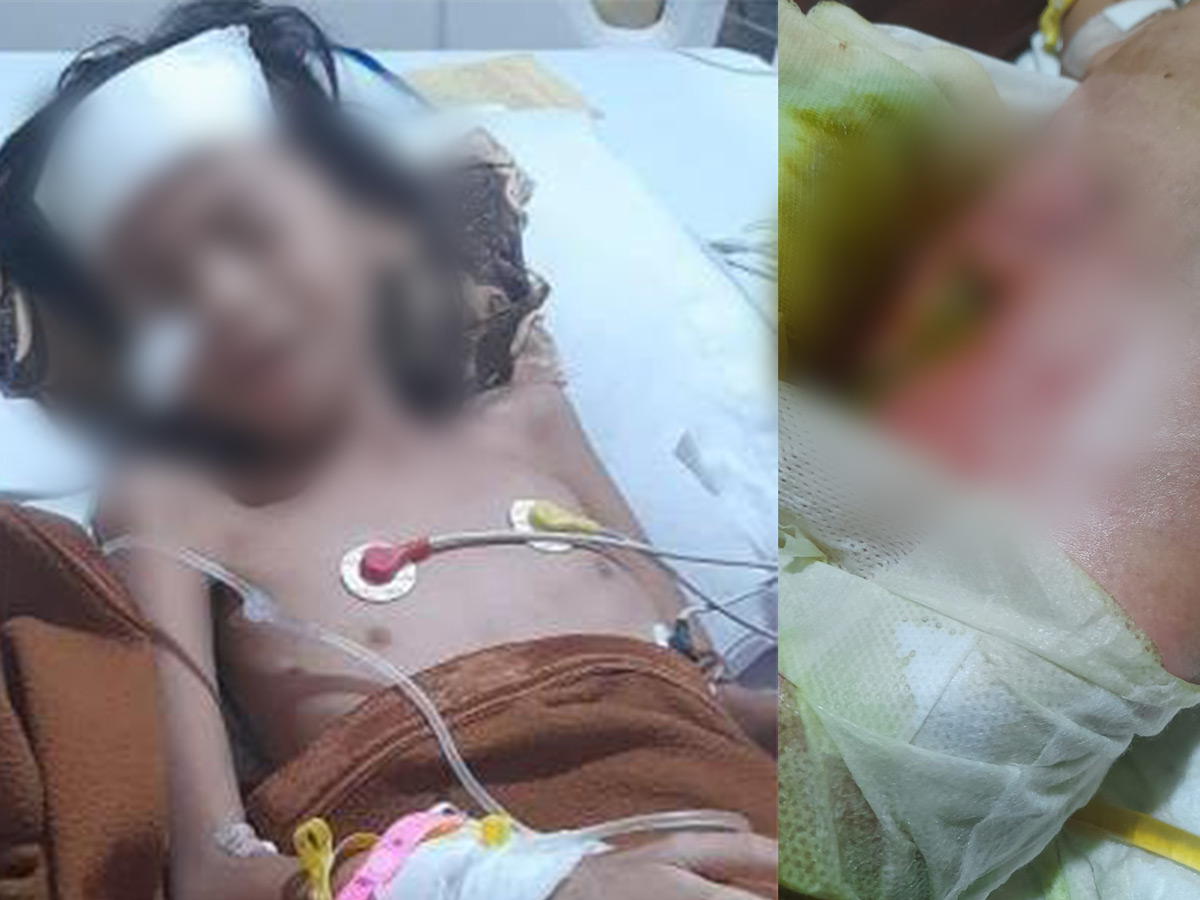 Anak Perempuan 7 Tahun Diduga Alami Kesalahan Prosedur Pasca Operasi