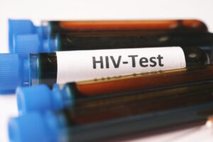689 Warga Sumsel Terjangkit HIV/AIDS Sepanjang Tahun 2023