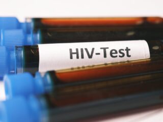 689 Warga Sumsel Terjangkit HIV/AIDS Sepanjang Tahun 2023